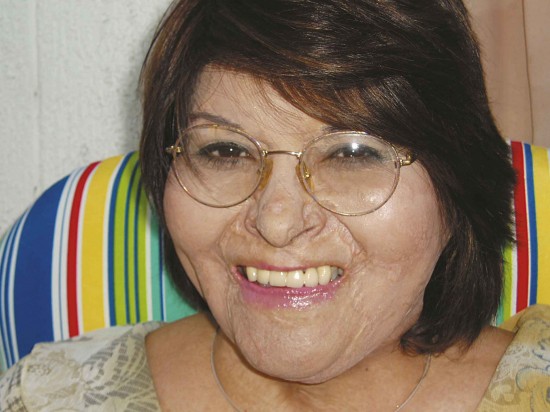 Carmen Gloria Quintana