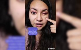 Natalia Aravena, víctima de trauma ocular, repudió "Apoyatón" a Carabineros