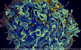La mujer parece haber logrado "la eliminación completa de todos los provirus del VIH-1 competentes para la replicación durante la infección natural", afirmaron los investigadores.