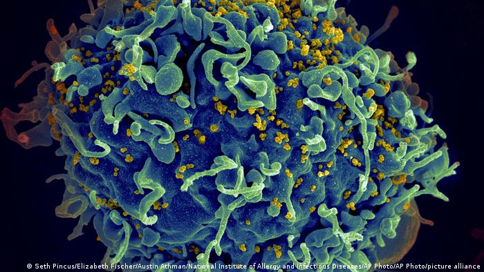 La mujer parece haber logrado "la eliminación completa de todos los provirus del VIH-1 competentes para la replicación durante la infección natural", afirmaron los investigadores.