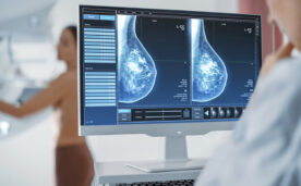 Prueban en Chile algoritmo que permitiría predecir riesgo de cáncer de mamas a través de mamografías
